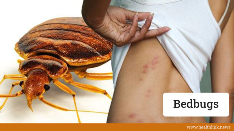 Bedbugs-Healthlink.news