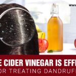 Apple Cider Vinegar-Dandruff