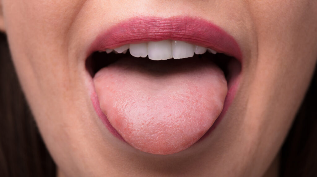 smooth-tongue