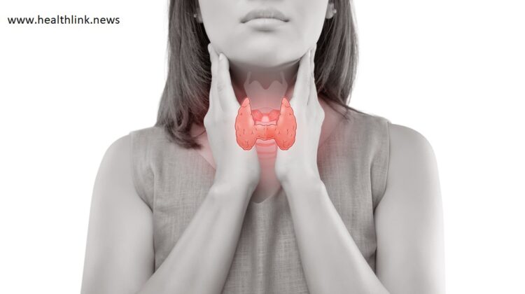 Hypothyroidism, thyroid problems
