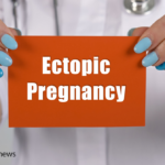 What is Ectopic Pregnancy