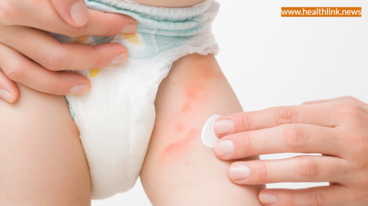 Tips to Care For Your Baby Skin in Right Way