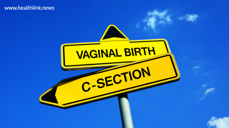 Vaginal birth after a C-section