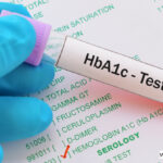 Hemoglobin A1c (HbA1c) Test