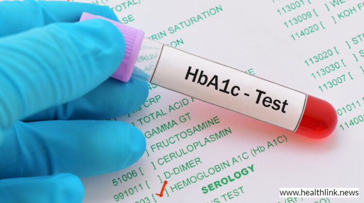 Hemoglobin A1c (HbA1c) Test