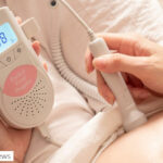 Pregnancy Fetal Heart Monitoring