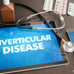 Diverticulosis & Diverticulitis Causes, Symptoms and Treatment