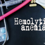 Autoimmune Hemolytic Anemia-Causes, Types & Treatment