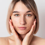 What Happens to Your Skin if You Have PCOS