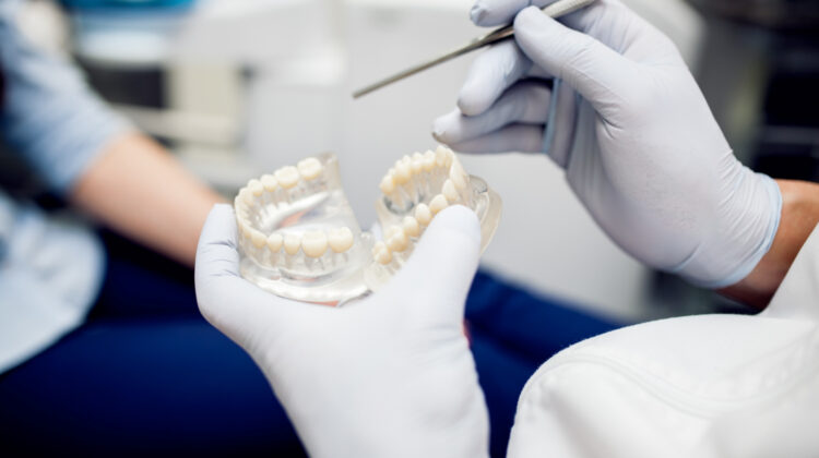 Dental Bridges Types, Uses, Benefits, and Different Parts