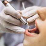 Exploring Dental Implants Types and Treatment Options