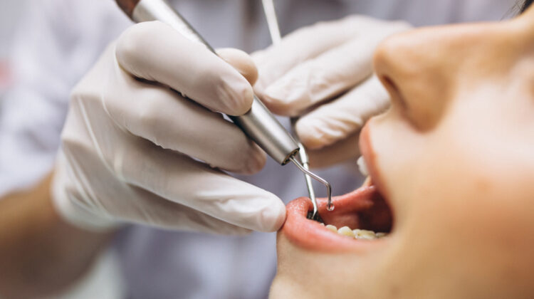 Exploring Dental Implants Types and Treatment Options