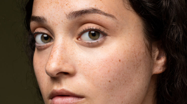 How to Take Care of Your Skin and Avoid Blackheads