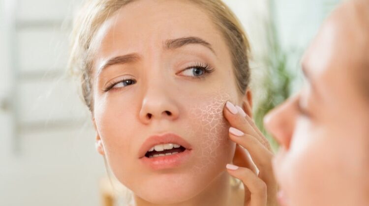 12 Home Remedies for Dry Skin Get Rid of itchy, flaky, and it