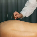 Acupuncture - Why it is Used, Benefits and Risk Factors